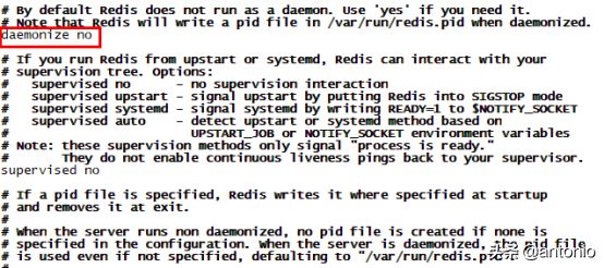 详解Redis